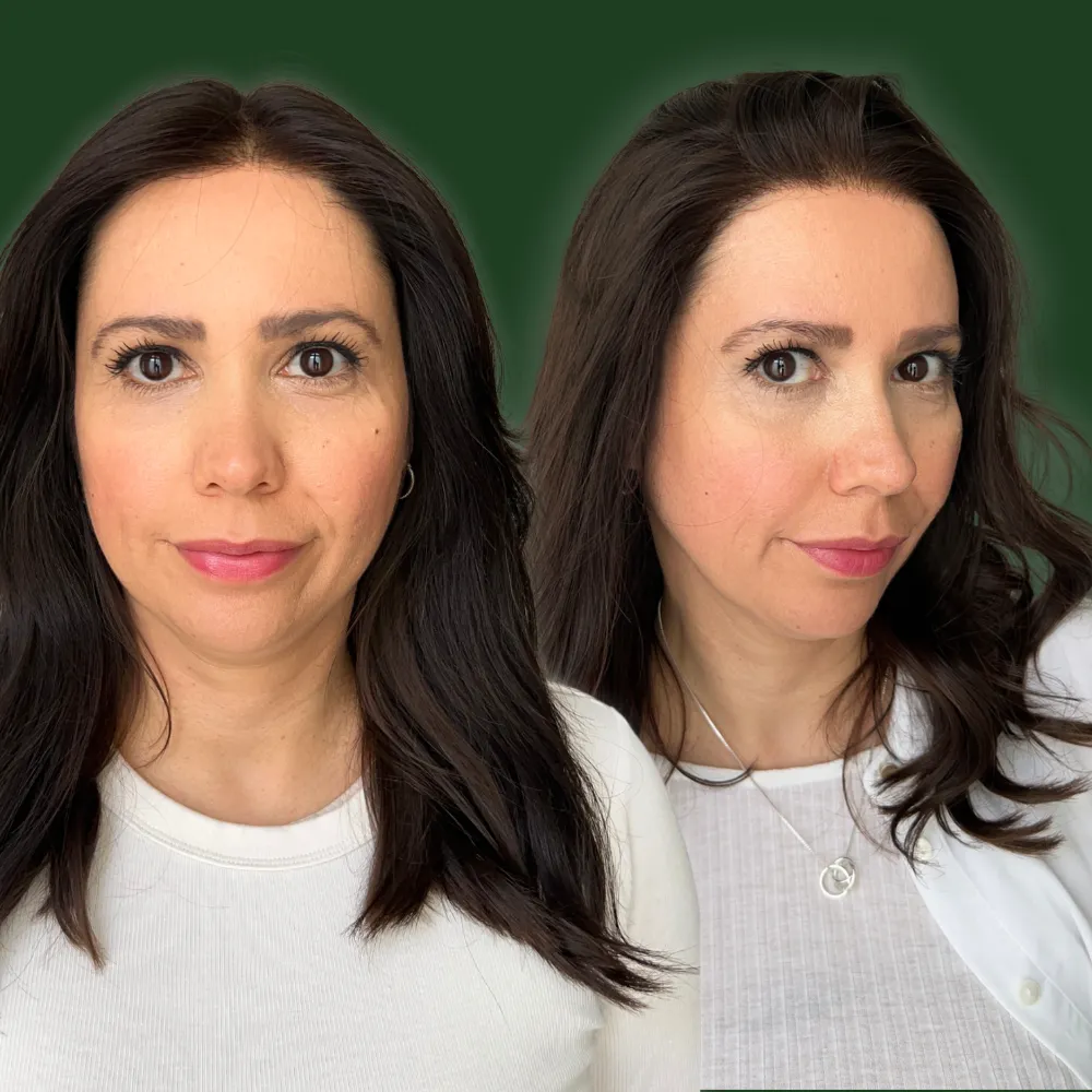 Topper or wig: me wearing a human hair topper on one side and a full wig on the other, to compare the two looks